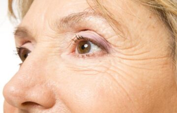 Jak opóźnić proces starzenia się skóry?